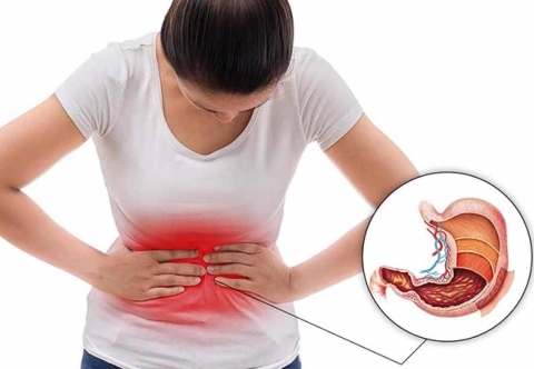 Viêm dạ dày mạn tính - Cách phân loại và phòng ngừa